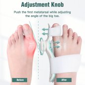 Korektor na haluxy (vybočený palec) - Ortéza ortopedický korektor palca nohy - Hallux Valgus