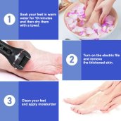 Máquina de pedicura (lima para pies) - Raspador eléctrico para pies, removedor de durezas para pies + resistente al agua - juego de 10 accesorios