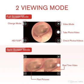 Otoscope wifi - öronendoskop med 3,9 mm diameter HD-kamera med LED för iOS och Android